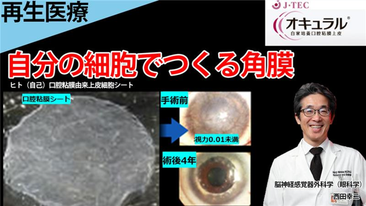 スライド画像