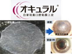 オキュラル