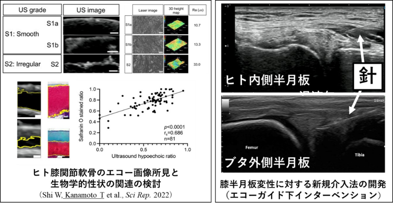 筋・腱・半月板=運動器疾患の診断と治療の改善を目指した基礎研究 画像
