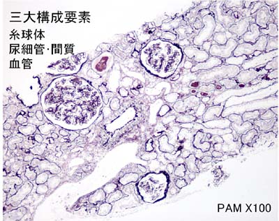 正常の腎組織 PAMX100