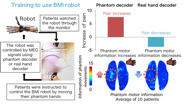 Figure 3: BMI neurofeedback for phantom limb pain