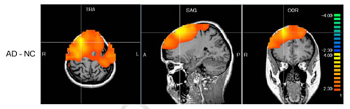 Fig.2