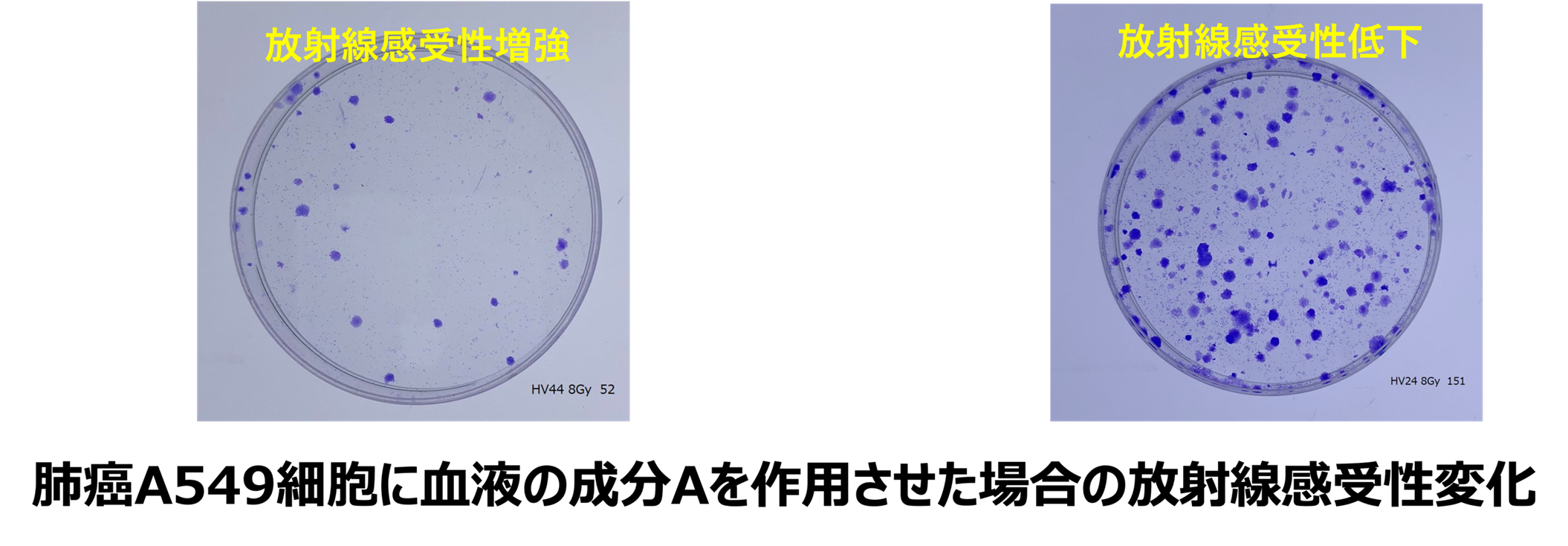 血液中の成分から放射線感受性に影響する因子に関する解析