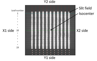 図1　EPIDを用いたGarden fence試験