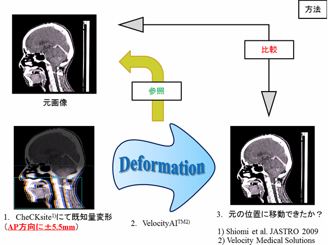 異種計画画像融合ソフトのdeformable image registrationの正確性