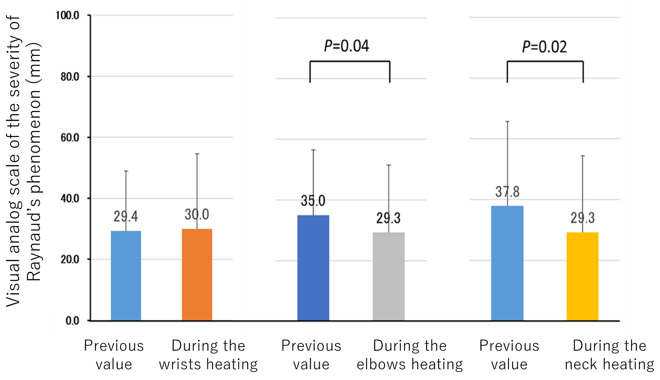 Site-specific heating effect on Raynaud's phenomenon