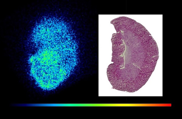 (High resolution imaging of mouse kidney)