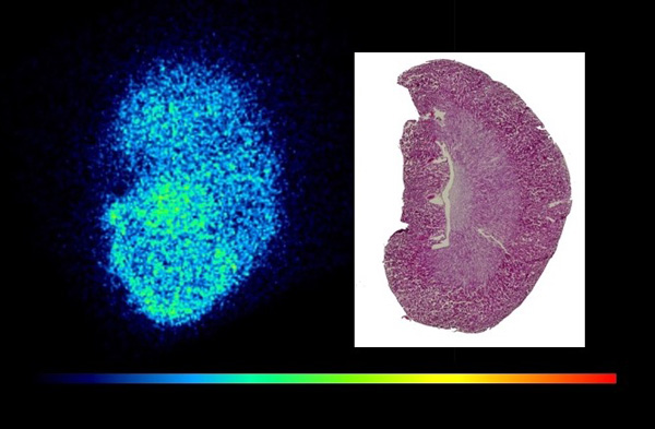 (マウス腎臓の高分解能イメージング