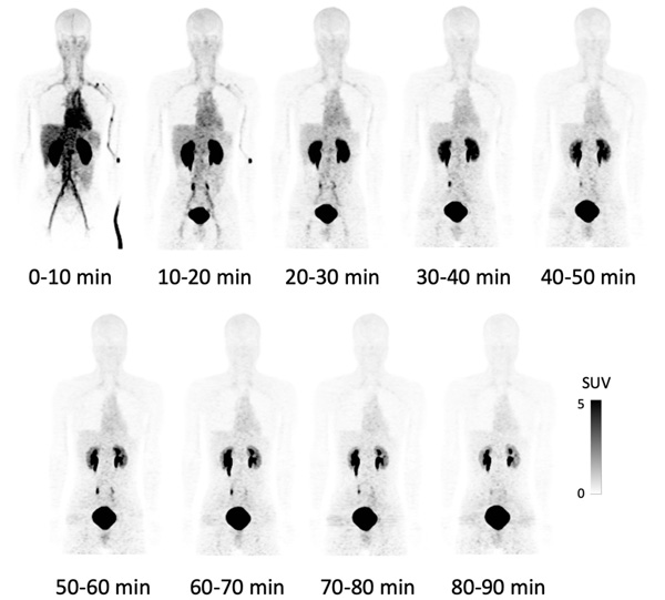 健康成人男性におけるF-18 NKO-035 PET画像 LAT1選択性の高さを反映し、腎臓からの排泄以外に有意な生理的集積を認めず。