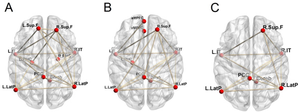 Schema of functional correlation in DMN