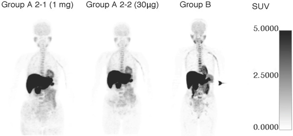 11C-donepezil PET image （Group A: DNP oral administration group, Group B: DNP non-oral administration group)