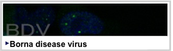 BDV:Borna Disease Virus