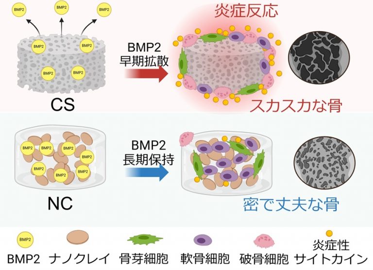 古市 拓也、海渡 貴司、岡田 誠司 ≪整形外科学≫ 次世代の骨再生治療! ナノクレイゲル×BMP2で副作用のない良質な骨再生を実現 | 大阪 ...
